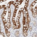 Cytokeratin 20 Polyclonal Antibody