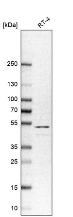 Cytokeratin 20 Antibody in Western Blot (WB)