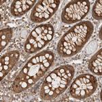 VPS28 Polyclonal Antibody