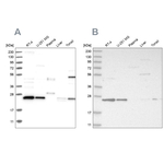 VPS28 Antibody in Western Blot (WB)