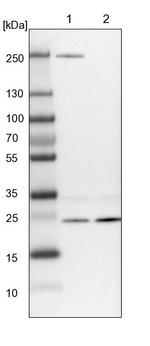 VPS28 Antibody in Western Blot (WB)