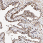VPS28 Antibody in Immunohistochemistry (Paraffin) (IHC (P))