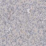 VPS28 Antibody in Immunohistochemistry (Paraffin) (IHC (P))