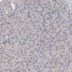 VPS28 Polyclonal Antibody