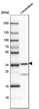 Carbonic Anhydrase VIII Antibody in Western Blot (WB)
