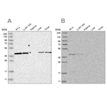 ACAT2 Antibody in Western Blot (WB)