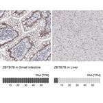 ThPOK Antibody in Immunohistochemistry (Paraffin) (IHC (P))
