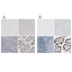 ThPOK Antibody in Immunohistochemistry (Paraffin) (IHC (P))