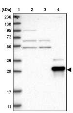 ZNF397 Antibody in Western Blot (WB)