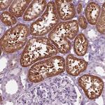 SLC27A2 Antibody in Immunohistochemistry (Paraffin) (IHC (P))