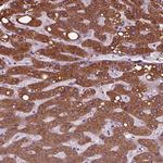 SLC27A2 Antibody in Immunohistochemistry (Paraffin) (IHC (P))