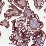 SLC27A2 Polyclonal Antibody