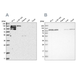 PYK2 Antibody in Western Blot (WB)