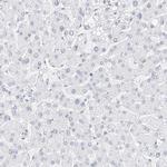 Nestin Antibody in Immunohistochemistry (Paraffin) (IHC (P))