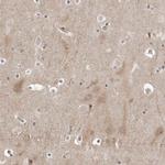 PYK2 Polyclonal Antibody