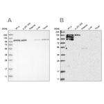 PYK2 Antibody in Western Blot (WB)