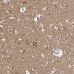 CaMKII delta Polyclonal Antibody