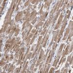 CaMKII delta Antibody in Immunohistochemistry (Paraffin) (IHC (P))
