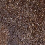 PKC eta Antibody in Immunohistochemistry (Paraffin) (IHC (P))