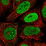 RPA2 Polyclonal Antibody