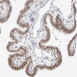 RPA2 Antibody in Immunohistochemistry (Paraffin) (IHC (P))