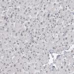 RPA2 Antibody in Immunohistochemistry (Paraffin) (IHC (P))