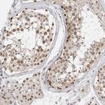 RPA2 Antibody in Immunohistochemistry (Paraffin) (IHC (P))