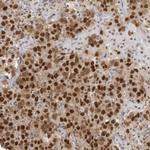 RPA2 Antibody in Immunohistochemistry (Paraffin) (IHC (P))