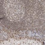 RPA2 Antibody in Immunohistochemistry (Paraffin) (IHC (P))