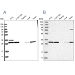 RPA2 Antibody in Western Blot (WB)