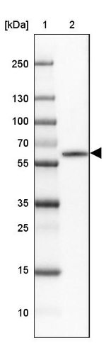 CaMKII beta Antibody in Western Blot (WB)