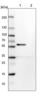 CaMKII beta Antibody in Western Blot (WB)