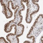 RPA2 Antibody in Immunohistochemistry (Paraffin) (IHC (P))