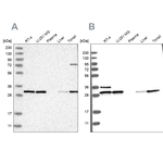 RPA2 Antibody in Western Blot (WB)