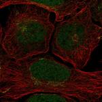 Claspin Polyclonal Antibody