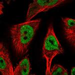 HDAC6 Polyclonal Antibody