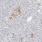 VLK Polyclonal Antibody
