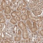 YES1 Antibody in Immunohistochemistry (Paraffin) (IHC (P))