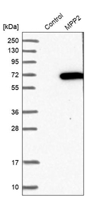 MPP2 Antibody in Western Blot (WB)