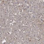 MST3 Antibody in Immunohistochemistry (Paraffin) (IHC (P))
