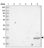 FLAP Antibody in Western Blot (WB)