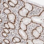 GTF2I Antibody in Immunohistochemistry (Paraffin) (IHC (P))