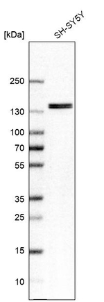 GTF2I Antibody in Western Blot (WB)