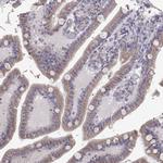 ERO1L Antibody in Immunohistochemistry (Paraffin) (IHC (P))