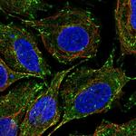 CLIP1 Polyclonal Antibody