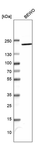 CLIP1 Antibody in Western Blot (WB)
