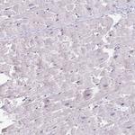 Carbonic Anhydrase III Polyclonal Antibody