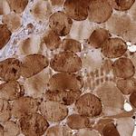 Carbonic Anhydrase III Antibody in Immunohistochemistry (Paraffin) (IHC (P))