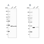 Carbonic Anhydrase III Antibody in Western Blot (WB)