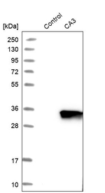 Carbonic Anhydrase III Antibody in Western Blot (WB)